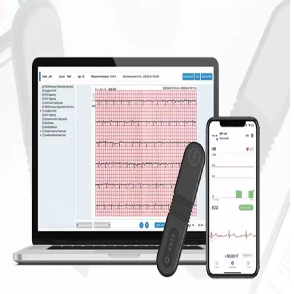 HOLTER 24 HORAS CON...